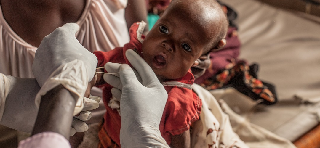 Baby Mabior* wird im Südsudan von einer unserer Krankenschwestern gegen Lungenentzündung behandelt. © Martin Kharumwa / Save the Children