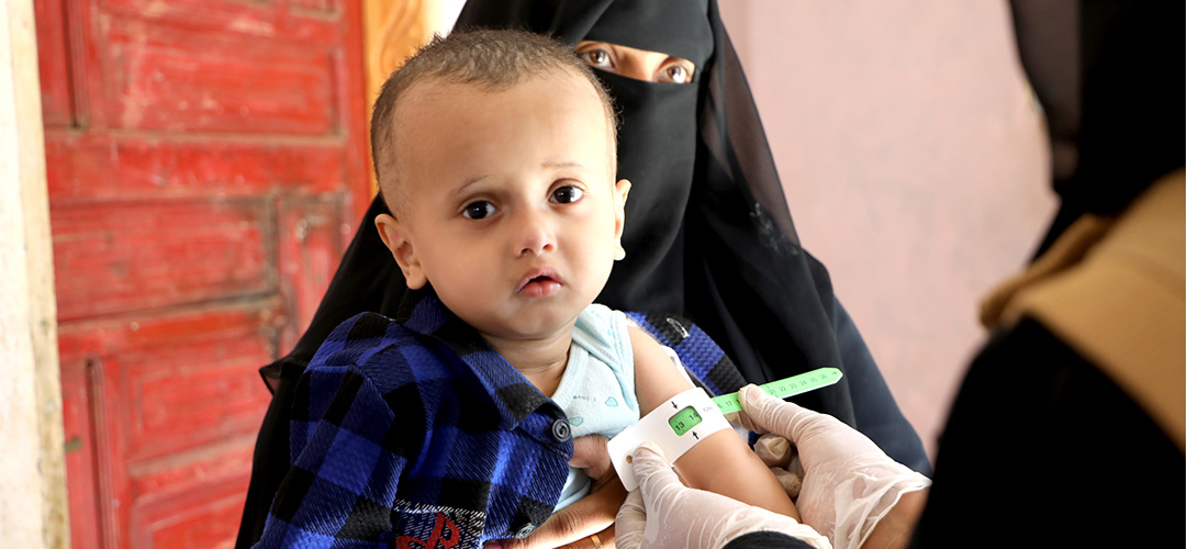 Der 15 Monate alte Amin* aus dem Jemen leidet an Mangelernährung. Seine Familie kann sich kaum noch Grundnahrungsmittel leisten und ernährt sich fast ausschließlich von Reis und Brot. © Hadil Saleh / Save the Children
