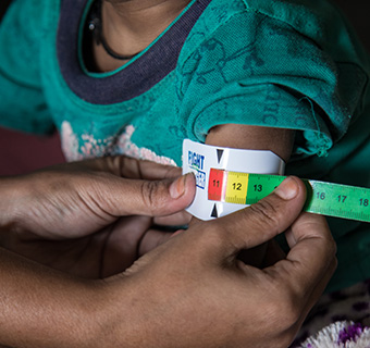 Bei einem 11 Monate alten Baby wird der Oberarmumfang gemessen. © Rajan Zaveri / Save the Children