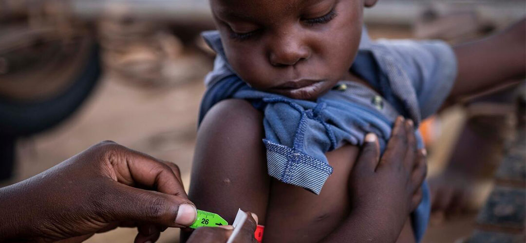 Tinashi* (4 Jahre alt) wird während einer von der Emergency Health Unit unterstützten Umfrage zur Ernährung und Nahrungsmittelsicherheit in Simbabwe, Afrika, untersucht. © Sacha Myers / Save the Children