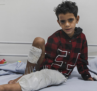 Der achtjährige Omar* überlebte einen Granatenangriff in Taiz, Jemen, nur knapp, während sein Bruder dabei ums Leben kam.