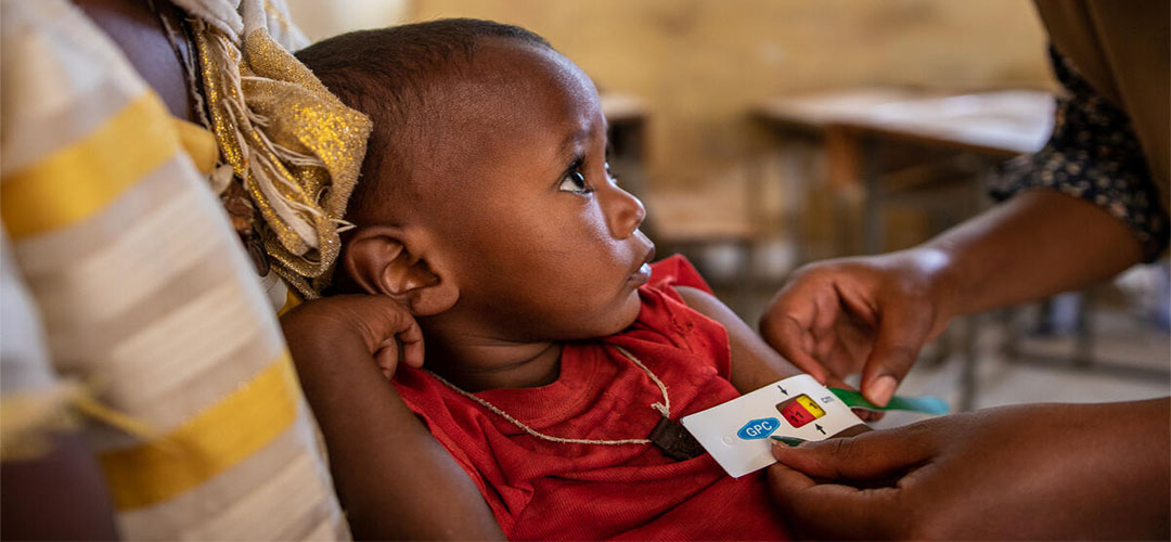 Der zweijährige Filmon* leidet aufgrund des bewaffneten Konflikts in Tigray, Äthiopien, an schwerer akuter Unterernährung.