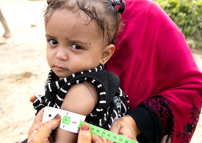 Gute Nachrichten: Die 15 Monate alte Afrah* aus dem Jemen ist nicht mehr mangelernährt. Das zeigt das MUAC-Armband an.