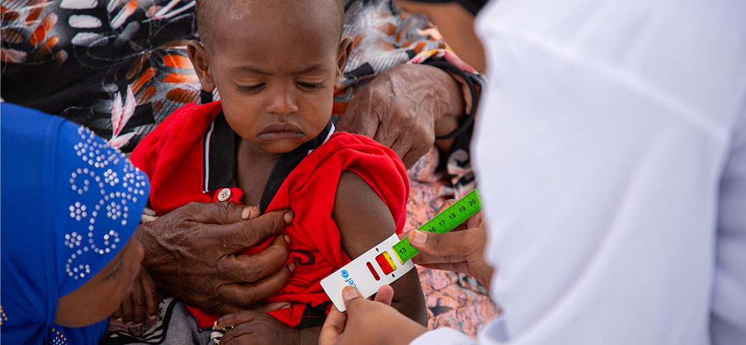 © Mustafa Saeed / Save the Children Ein kleiner Junge wird mithilfe eines MUAC-Bandes auf Mangelernährung untersucht.