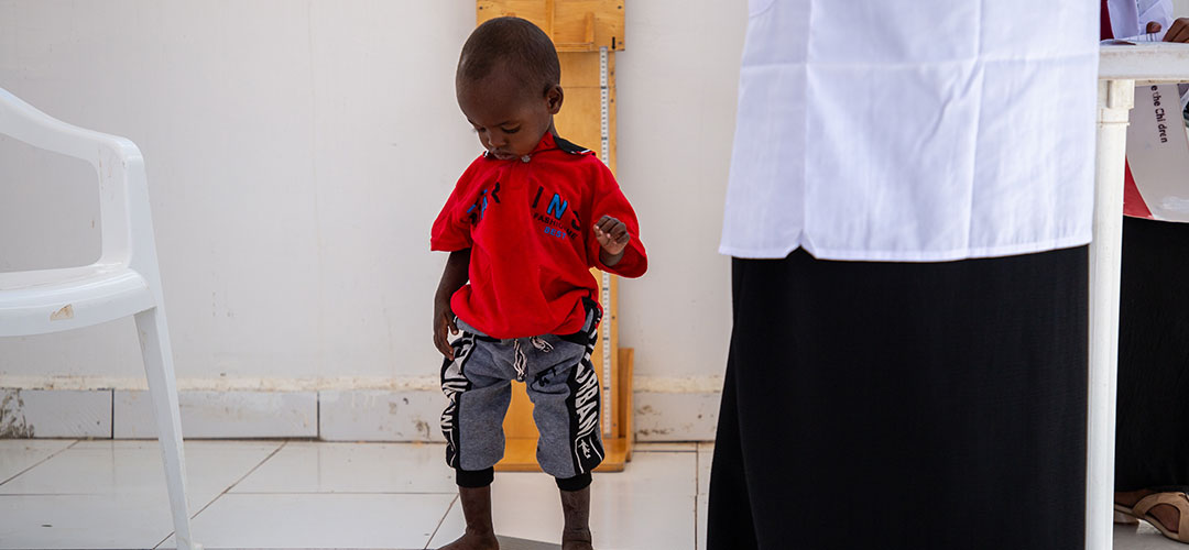Abdi war zu leicht für sein Alter. © Mustafa Saeed / Save the Children Einer kleiner Junge steht auf einer Waage und blickt nach unten.