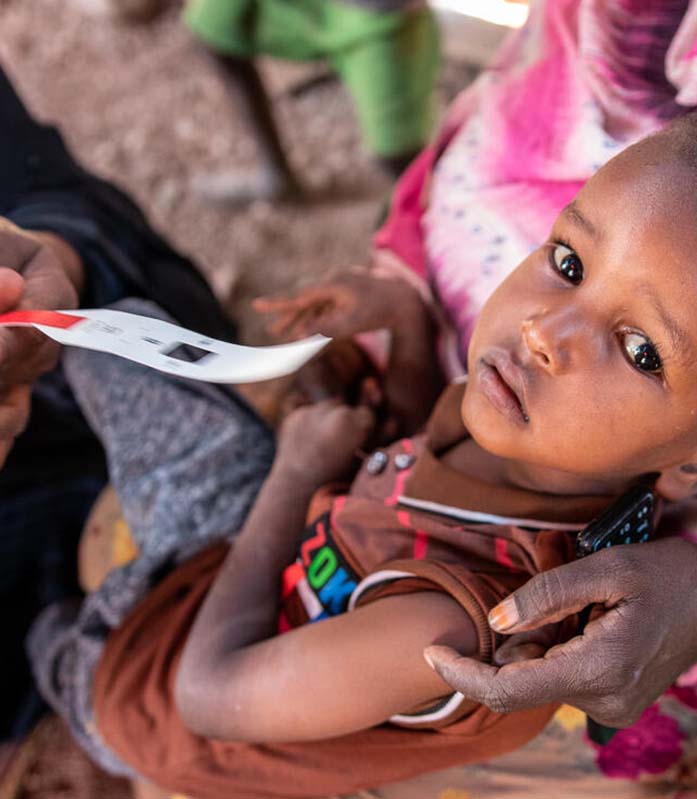 Ein Kind aus Somaila, Afrika, wird auf Mangelernährung hin untersucht in einem Programm von Save the Children.