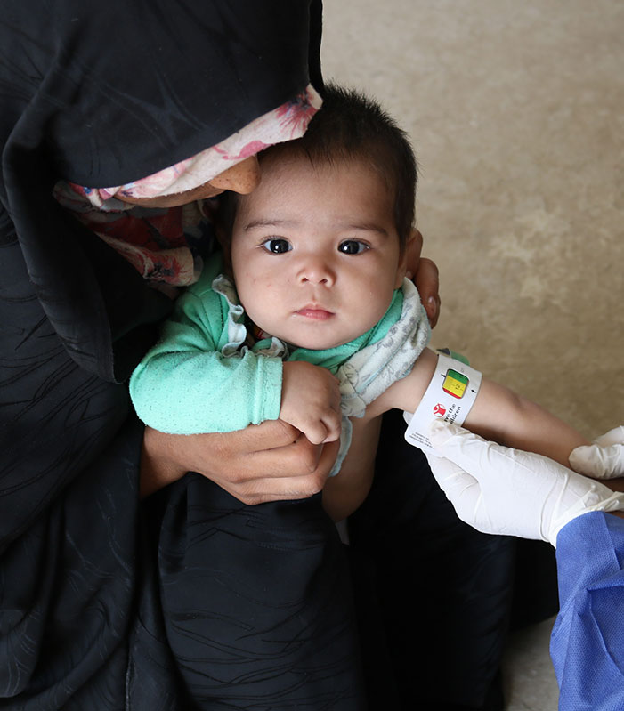 Mangelernährtes baby in Afghanistan