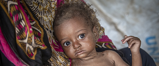 Kinder leiden unter der verheerenden Situation im Jemen besonders stark.